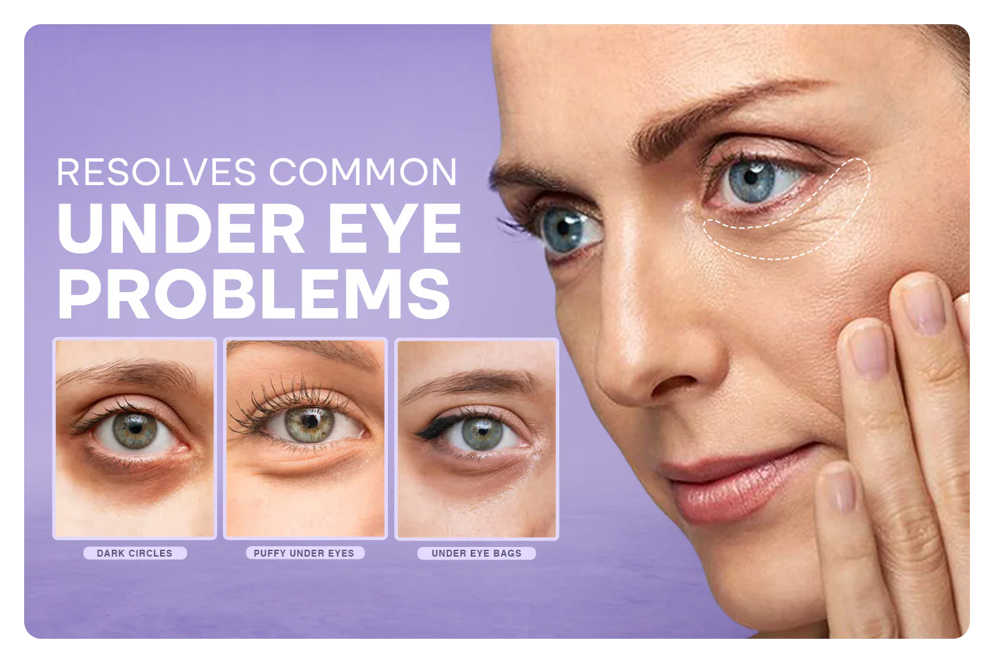 Under Eye Puffiness Remover